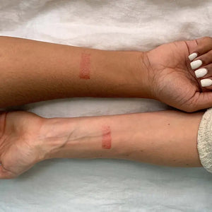 Two arms with red marks on a light background
