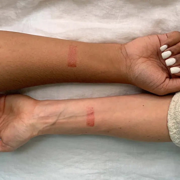 Two arms with red marks on a light background